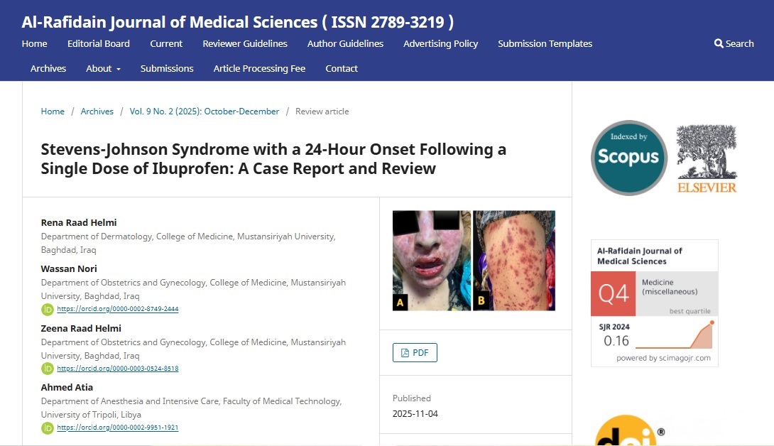 تدريسيو كلية طب المستنصرية ينشرون بحث علمي مشترك مع جامعة ليبية عن متلازمة ستيفنز–جونسون تدريسيو كلية طب المستنصرية ينشرون بحث علمي مشترك مع جامعة ليبية عن متلازمة ستيفنز–جونسون